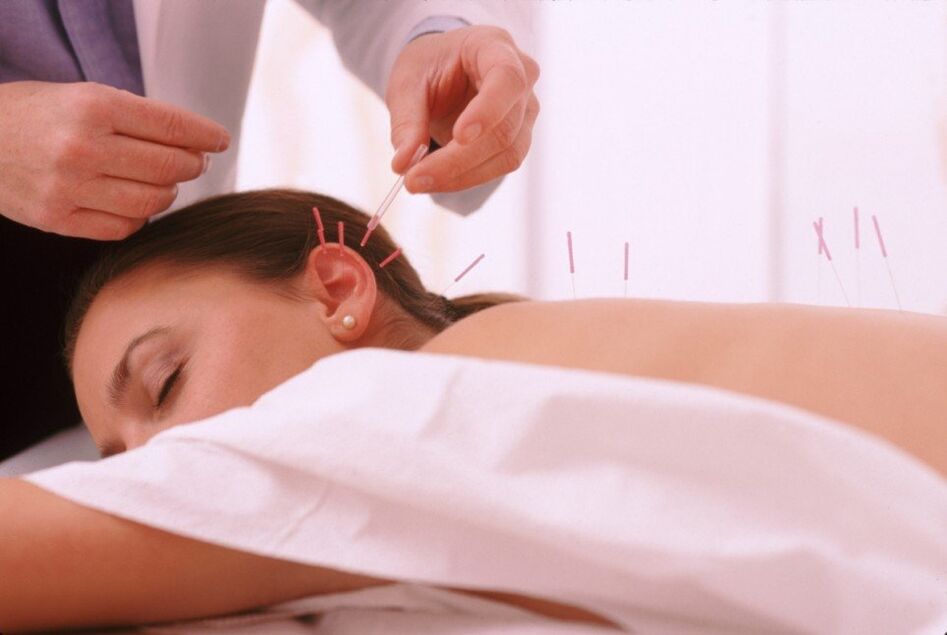 Acupunctuur en acupunctuur met cervicale osteochondrose