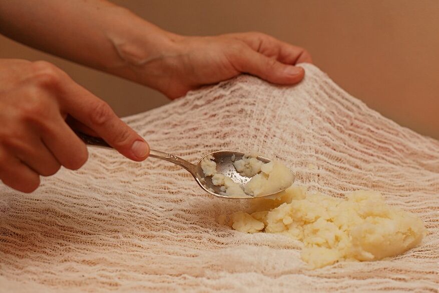 Compress van honing en aardappelen