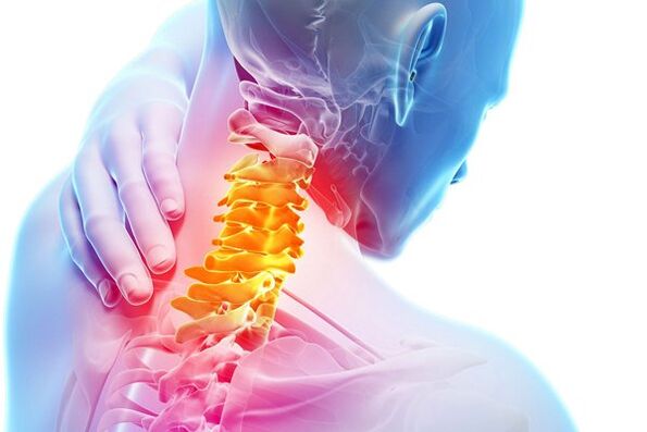 De oorzaken van cervicale osteochondrose