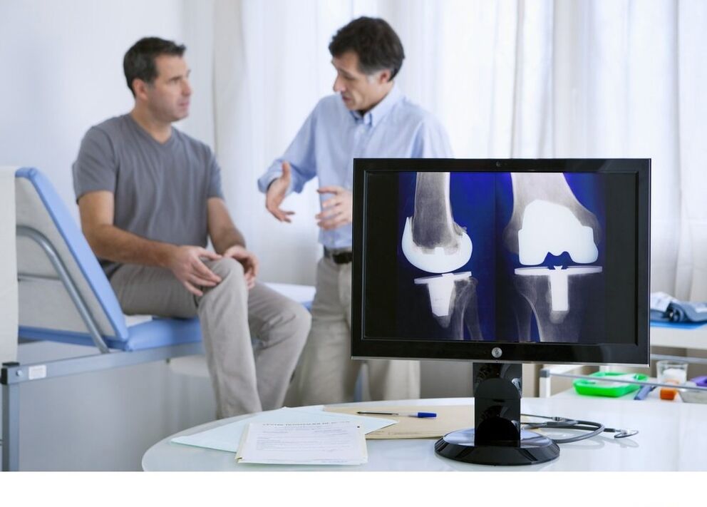 Arthrose van het kniegewricht in het X -Ray -beeld